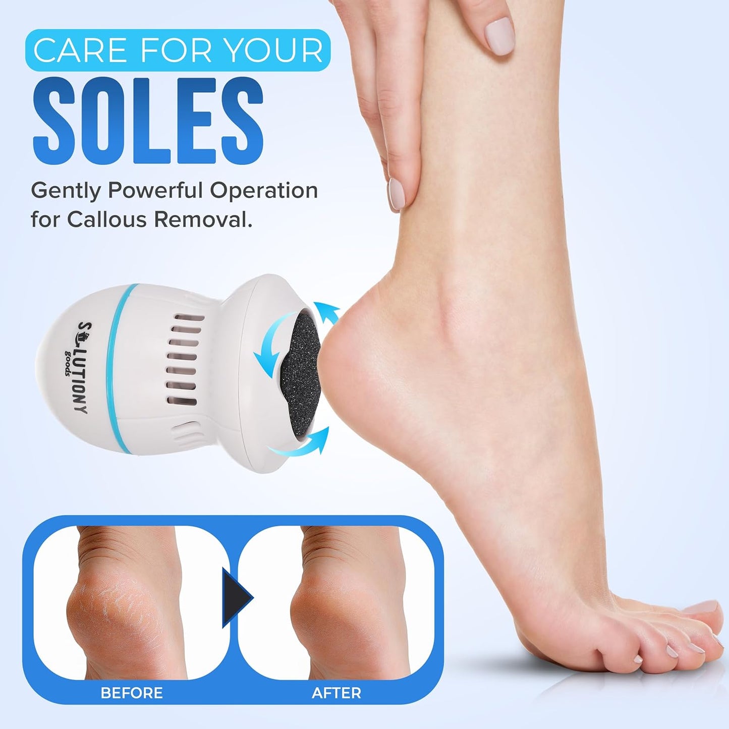Electric Foot Callus Remover - USB-Rechargeable With Built-in Vacuum for Dead Skin Removal, Portable Foot File