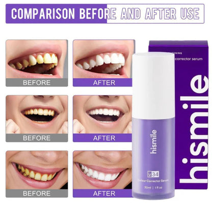 Hismile Purple Teeth Whitening Serum